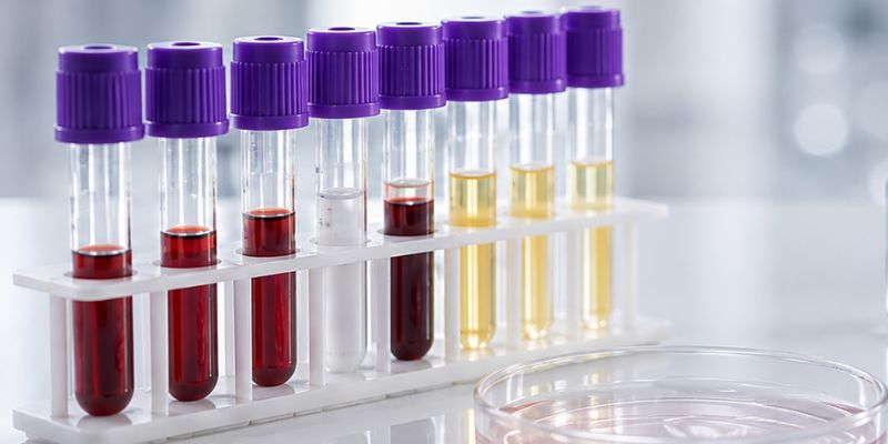 Especialista realizando estudios hormonales en laboratorio clínico