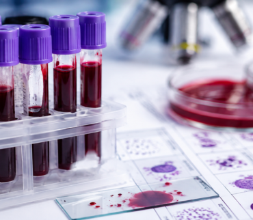 Estudios de Laboratorio Clínico | BioAquim Jalisco